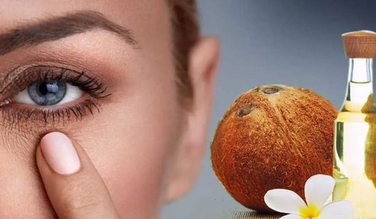 চোখের নিচে কালো দাগ দূর করার উপায়